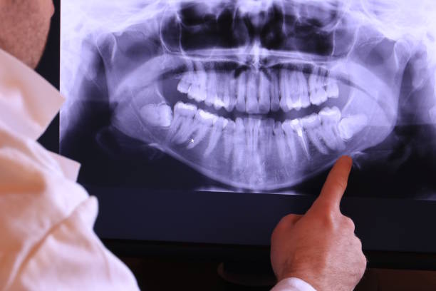 Best Weekend Emergency Dentist in Harvey, IL